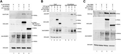 The Cajal body marker protein coilin is SUMOylated and possesses SUMO E3 ligase-like activity